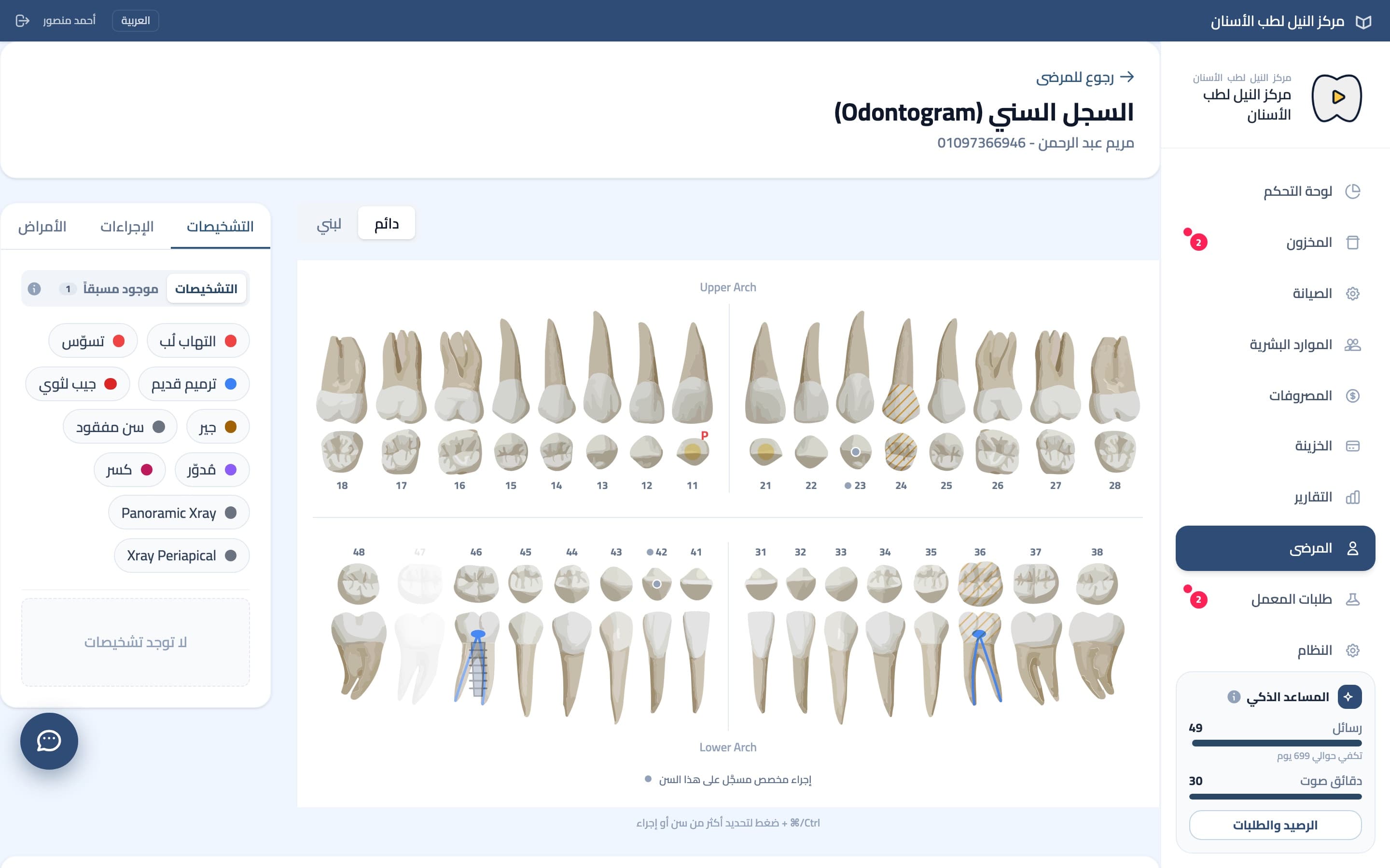مخطط أسنان تفاعلي فيه إجراءات مكتملة ومخططة